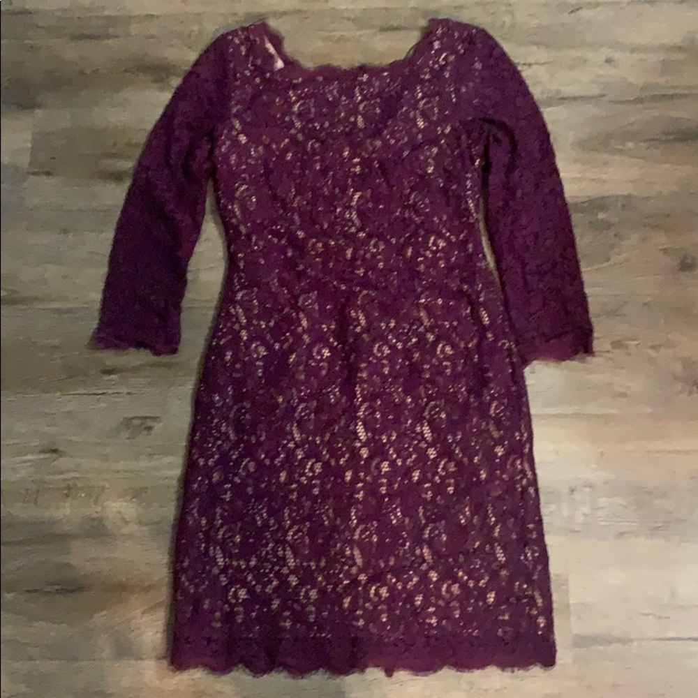 Lace Dress.